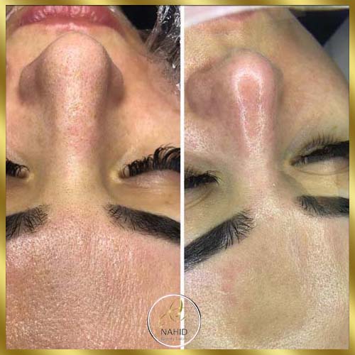 گالری پاکسازی پوست